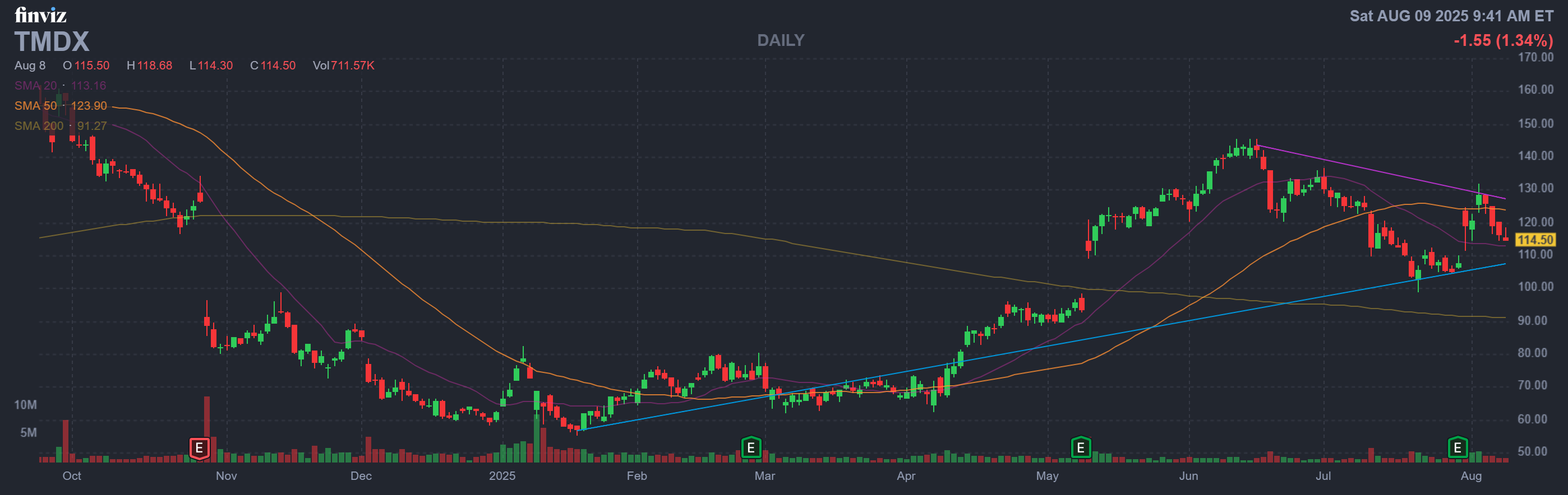 Finviz Chart