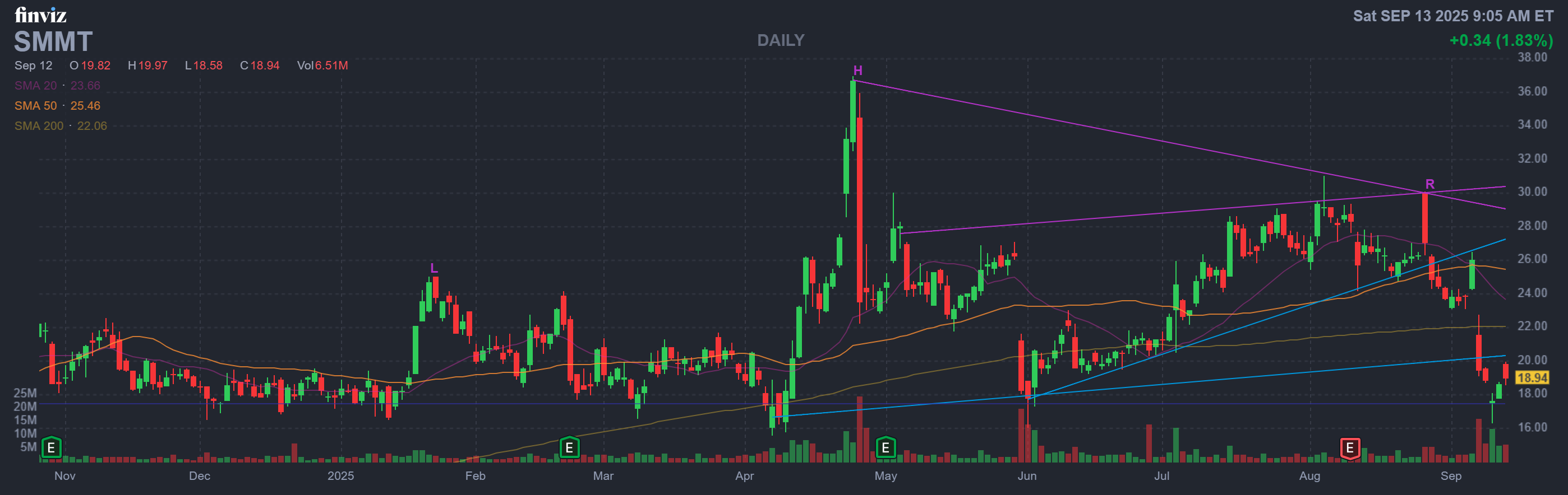 Finviz Chart