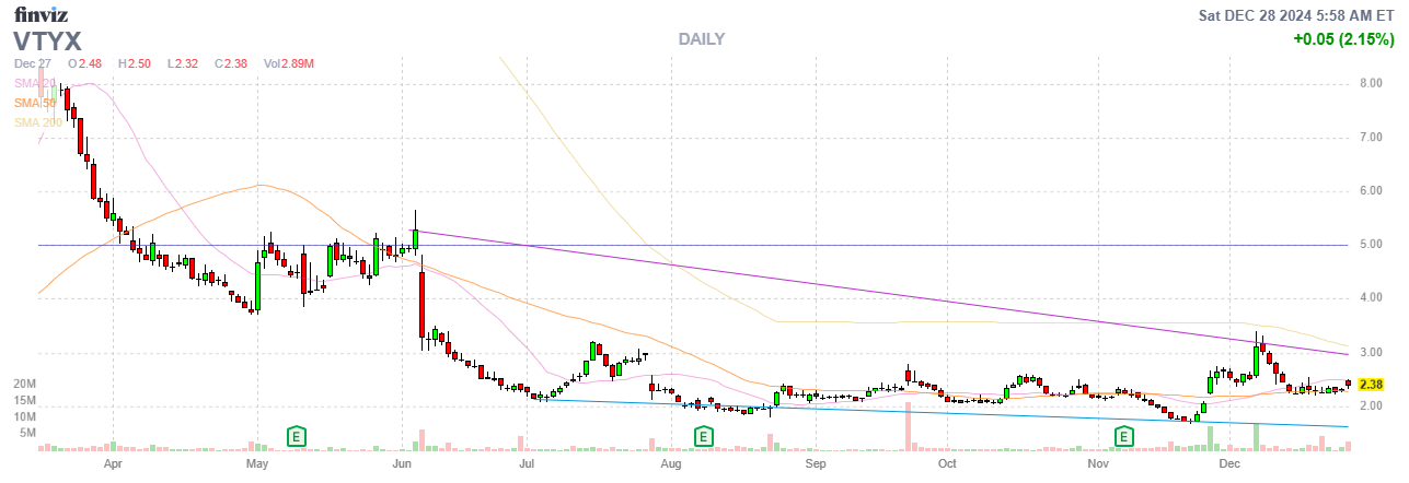 Finviz Chart